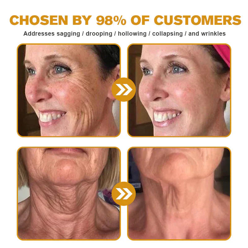 BeeRx™ Cream | Finally Break Free From The Endless Cycle of Failed Creams, Harsh Steroids & Empty Promises